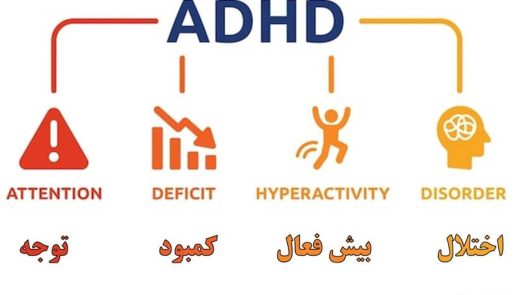 بیش فعالی